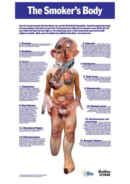 Plakat s navodnim bolestima koje nastaju od pušenja duhana. Efektan način dezinformiranja javnosti.