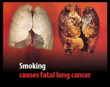 Na brojnim kutijama cigareta nalaze se zastrašujuće slike crnih pluća, koja navodno pripadaju preminulim pušačima, na žalost u pitanju je čista LAŽ, to nisu pluća pušača.