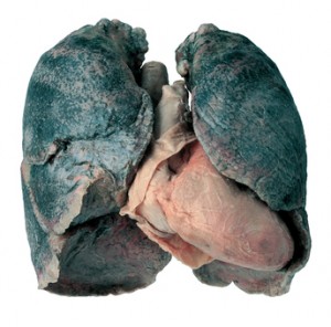 Ovo no nisu pušačka pluća, ovo je  pneumokonioza, bolest crnih pluća. koja uglavnom nastaje zbog udisanja ugljene prašine, no bez obzira na sve, nalaze se propagandnim materijalima koji tvrde - ovo su crna pušačka pluća.